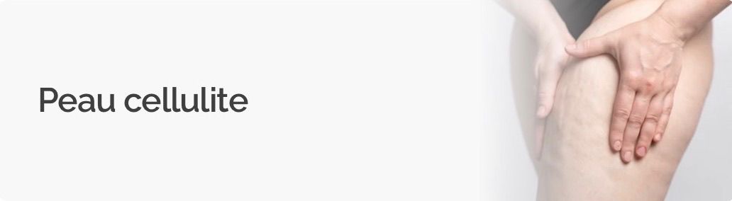 Peau cellulite